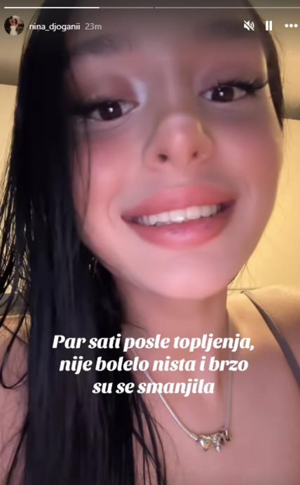 Nina Đogani pokazala proces smanjivanja usana