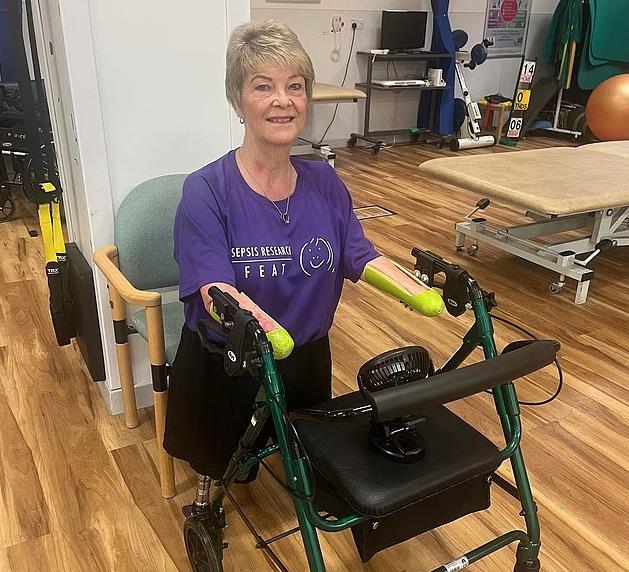 Kim Smit amputirali sve udove zbog urinarne infekcije.jpg