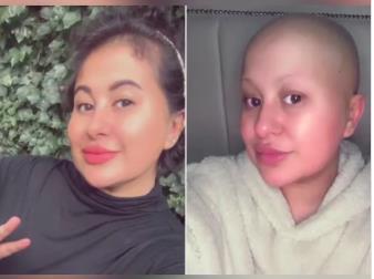 Sofija pre i posle hemioterapije.jpg