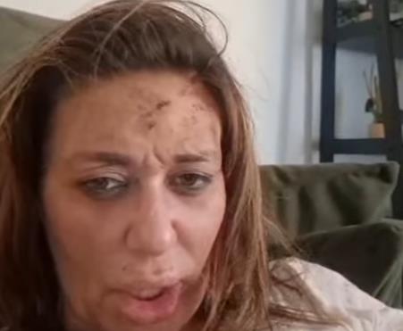 Ana Nikolić objavila snimak na kom je pretučena