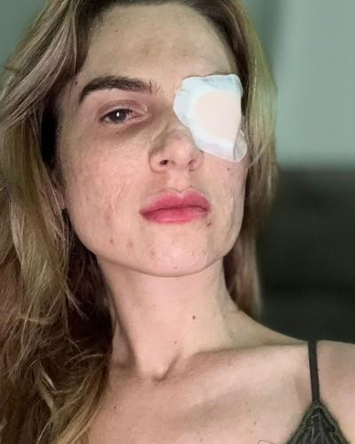 Žaklin popila ibuprofen za bolove, pa potpuno oslepela