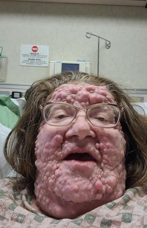 Mercedes Kristesen u bolnici.jpg