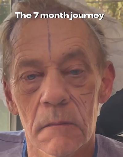 Dejl je uradio niz operacija na licu