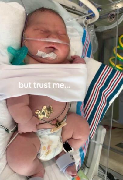 Kasijan Martin, dečak težak 6 kg po rođenju.jpg