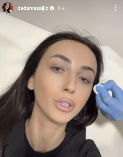 Dada Mešaljić objavila sliku sa klinike za ulepšavanje