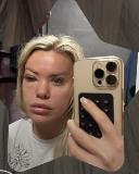 Sanja Stanković objavila snimak na kom joj je oko natečeno