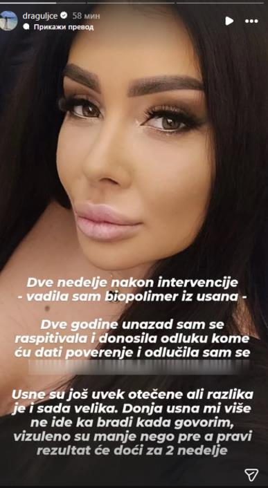 Zorica Dukić izvadila biopolimer