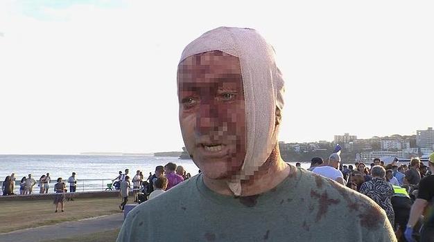 Australija Sidnej Bondi Beach Plaža žrtva (10).png