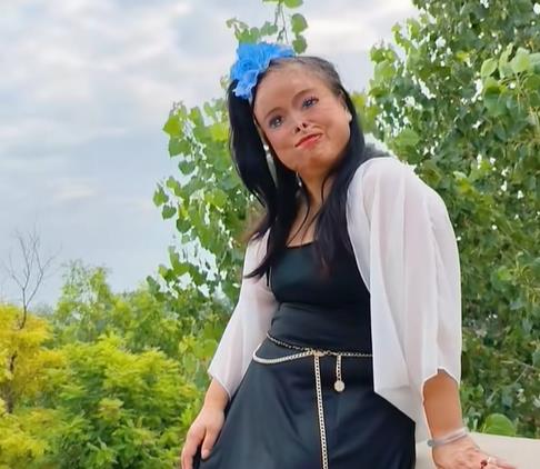 Žena crta kompletno lice jer ju je muž polio kiselinom