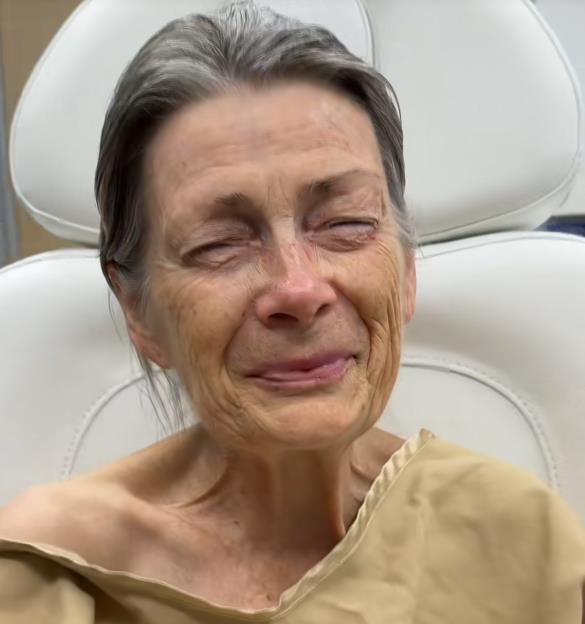 Žena pre fejsliftinga sa drastičnom promenom izgleda