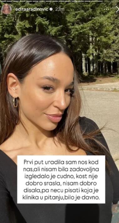 Edita Aradinović o estetskim zahvatima