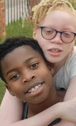 Blizanci Danijel i Dejvid Omirin iz Nigerije, jedan sa tamnom kožom, drugi sa svetlim tenom i zlatnom kosom zbog albinizma (2).PNG