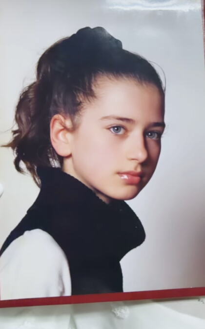 Milica Polskaja pre estetskih operacija (1).png