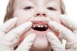 karijes-stockphotodentalmedicineandhealthcaredentistexamininglittlechildboypatientopenmouthshowing95328460.jpg