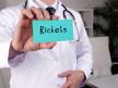 rahitis shutterstock_1884826321.jpg