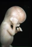 fetus-14.jpg