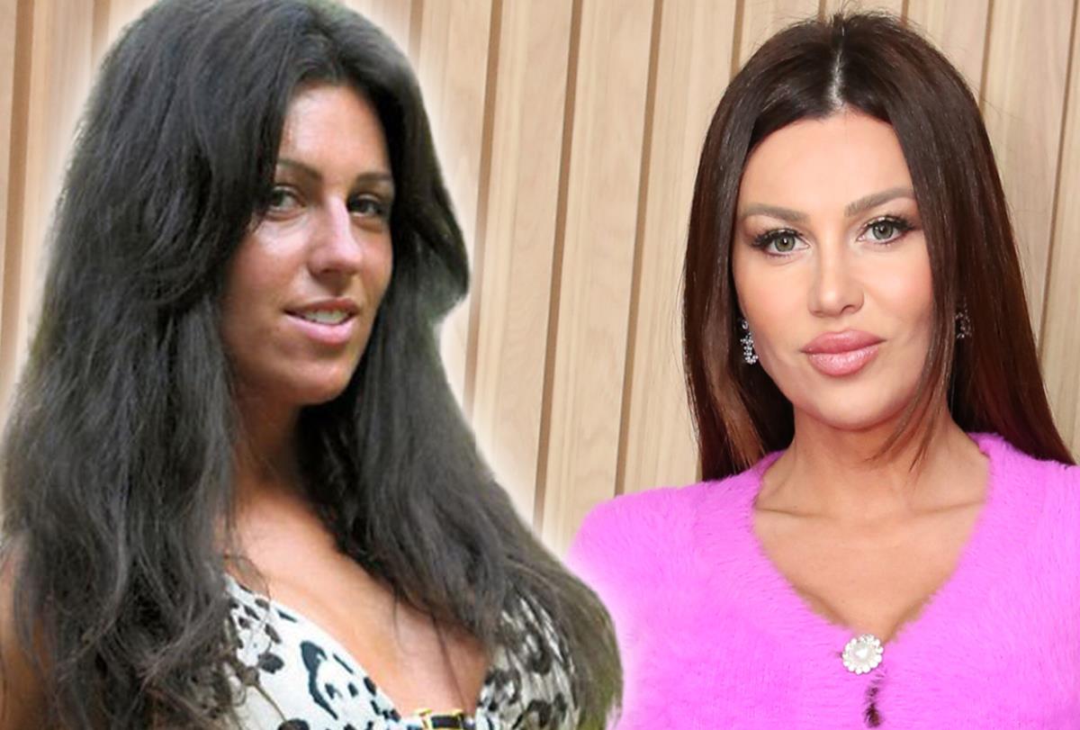 Evo kako je Stanija Dobrojević izgledala pre svih operacija