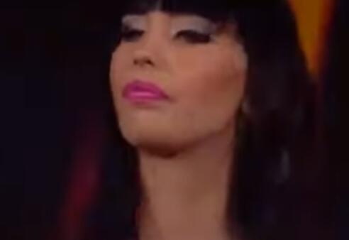 Katarina Grujić bila na operaciji očiju