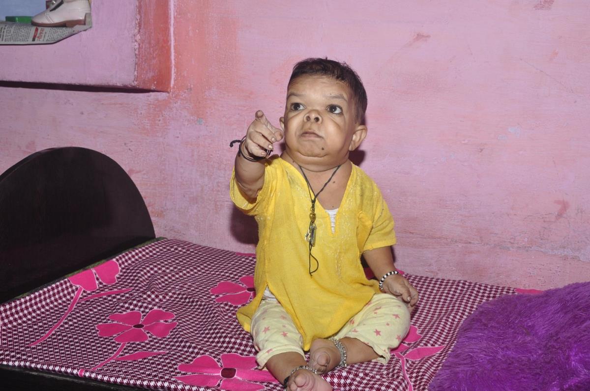 Ravi Kumar, odrastao čovek u telu deteta.jpg