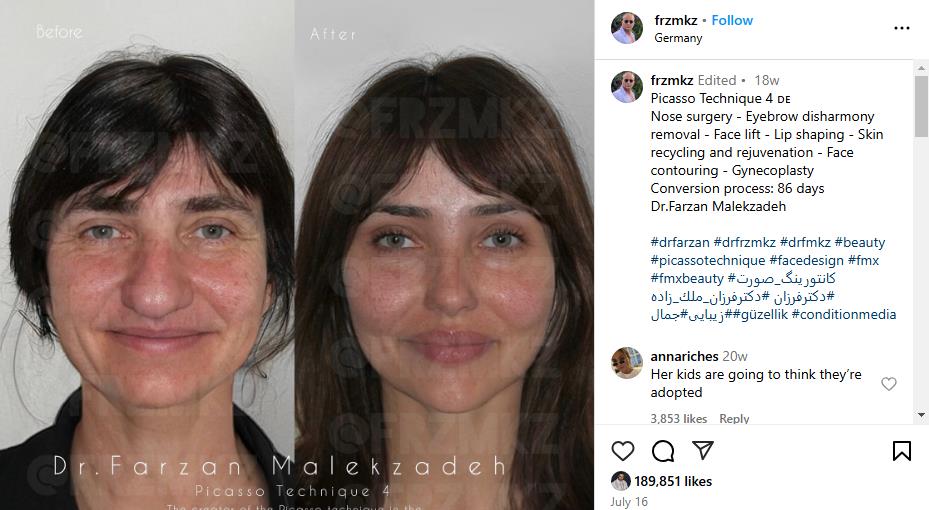 Turski hirurg promenio lični opis žene