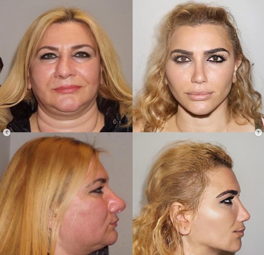 transformacija u Turskoj 2.jpg