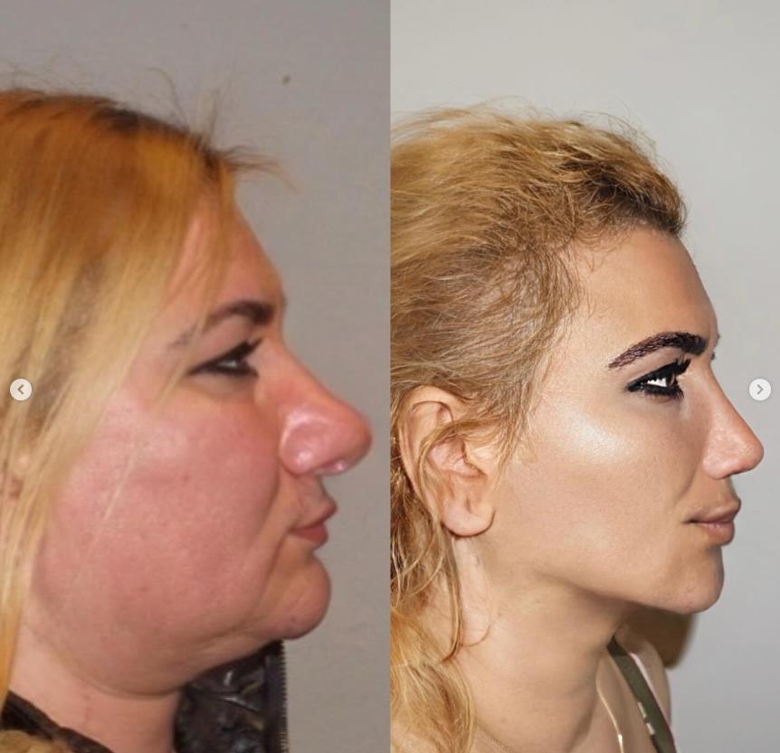 transformacija u Turskoj 1.jpg