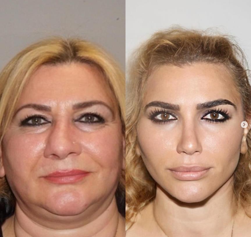 transformacija u Turskoj.jpg