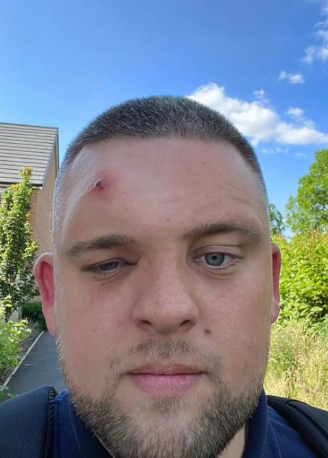 Džek Holmsa ujela konjska muva (1).png