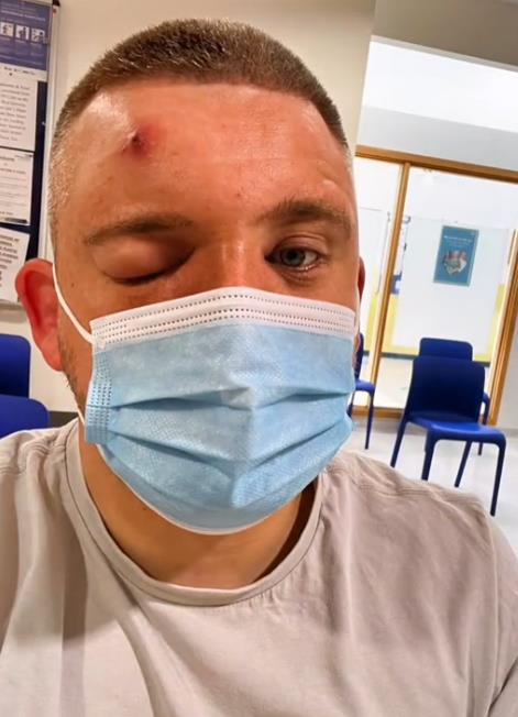 Džek Holmsa ujela konjska muva (3).png