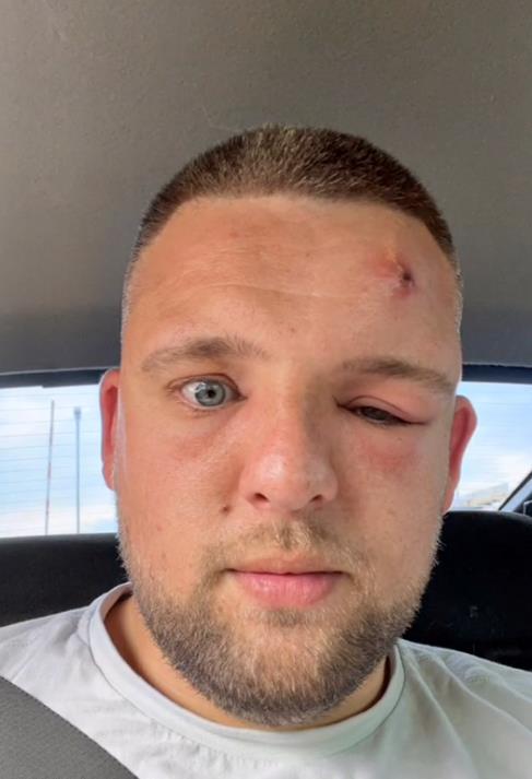 Džek Holmsa ujela konjska muva (4).png