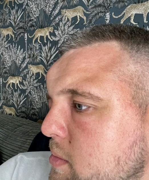 Džek Holmsa ujela konjska muva (5).png