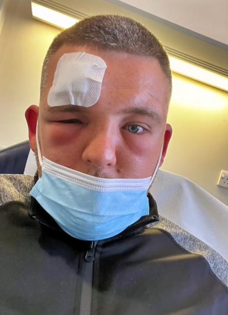 Džek Holmsa ujela konjska muva (7).png