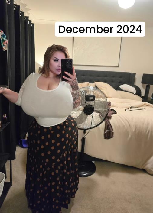 Ameliji Pejdž neprestano rastu grudi (3).png