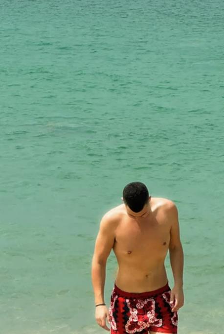 Lepa Brena slomljenu nogu leči u Tajlandu