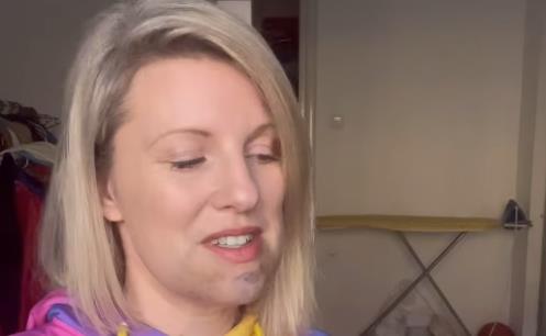 Lice pevačice ide Prester u podlivima i modricama