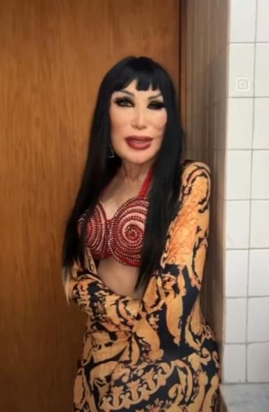 Lin Mej je nasamarena na estetski zahvat od svoje prijateljice 3.png