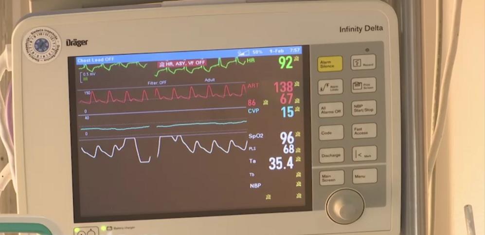 Transplantacija 6.png