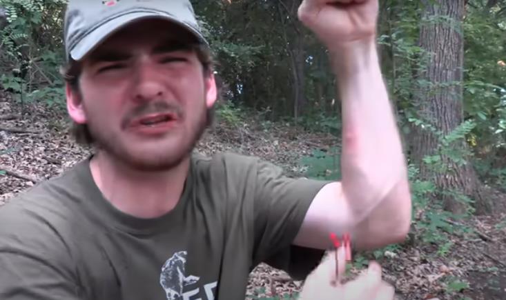 Ujed Crne udovice nije smrtonosan