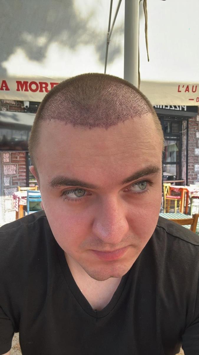 WhatsApp Image 2025-03-12 at 12.42.23 PM (2).jpeg