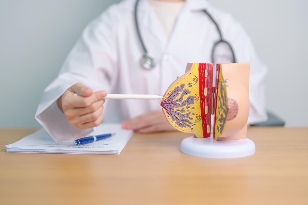 Lekar pokazuje anatomski model dojke koristeći pokazivač tokom medicinskog objašnjenja