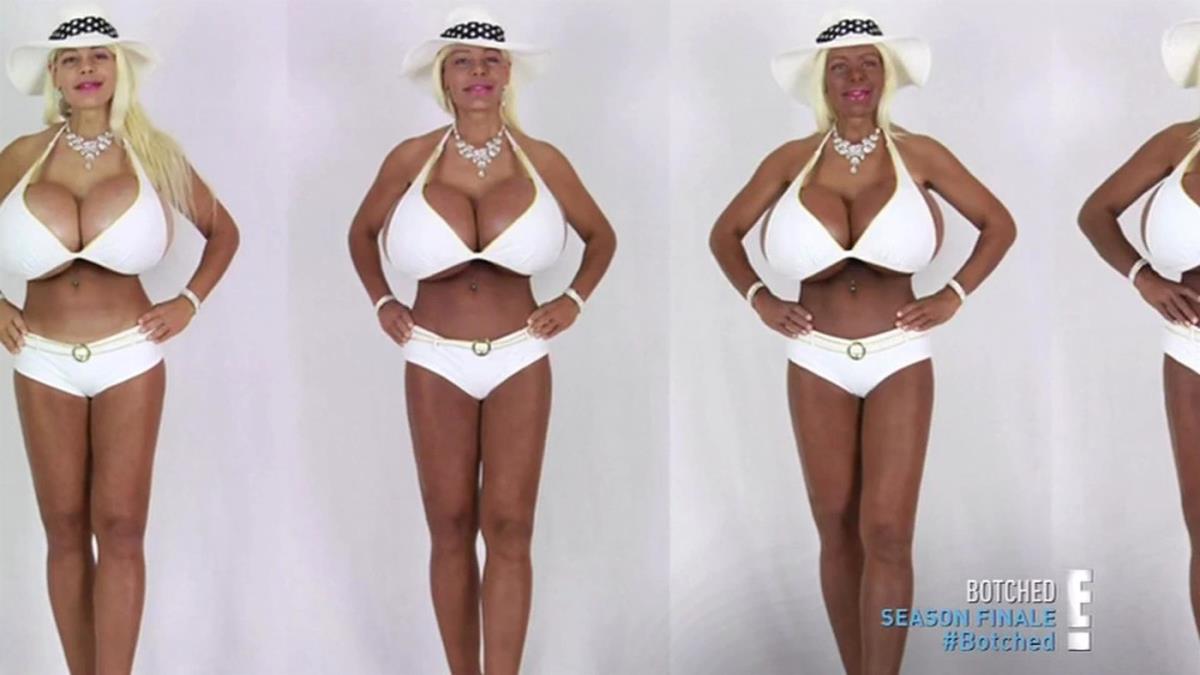 Martina Big nakon operacija profimedia-0378419795.jpg