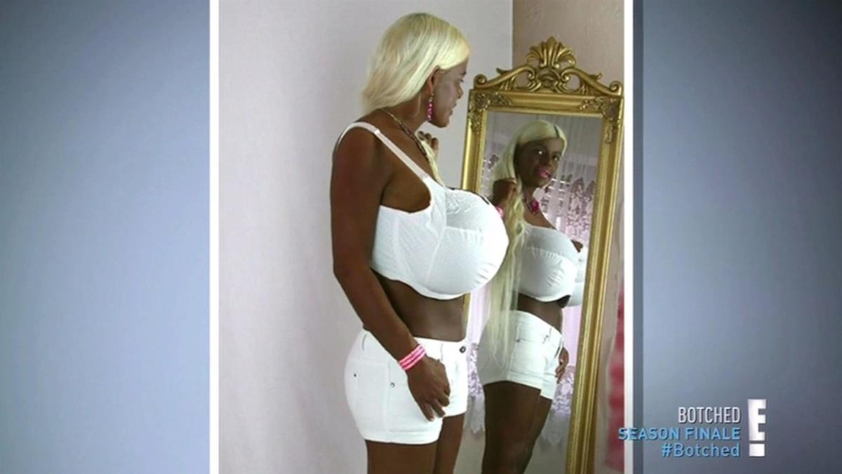 Martina Big nakon zahvata profimedia-0378420452.jpg