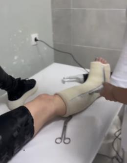 Maja Nikolić skinula gips