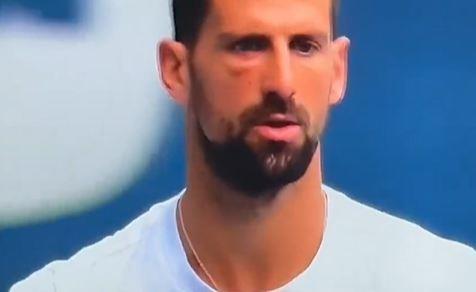 2025-03-30 22_03_50-José Morón on X_ _ESPN ha cazado a Djokovic así. El ojo derecho hinchado complet.jpg