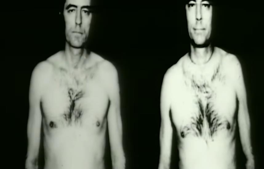 Blizanci Džim goli do pasa, uporedne fotografije