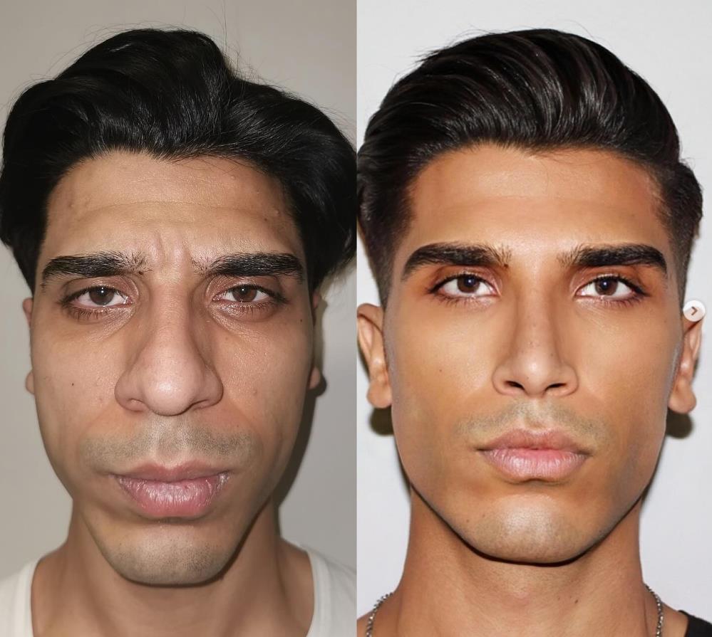 Mnogi korisnici su se zapitali kao će deci objasniti svoje gene