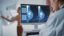 doktorka očitava rezultate mamografa na monitoru