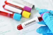 leukemija-shutterstock-1524564461.jpg