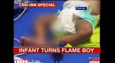 beba-samozapaljenje.jpg
