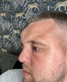 Džek Holmsa ujela konjska muva (5).png